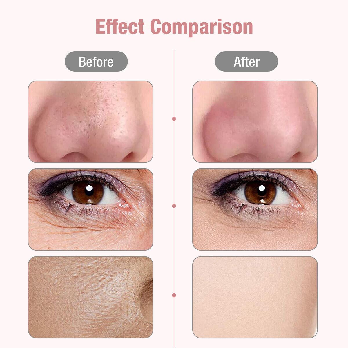 Deep Facial Pore Cleaner